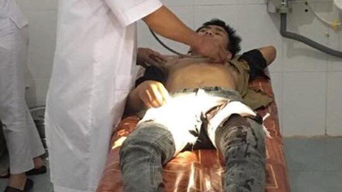 Mâu thuẫn cá nhân, nam sinh rút dao đâm bạn cùng lớp