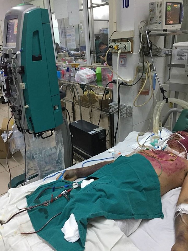 Tự điều trị thủy đậu, nam bệnh nhân bị suy đa phủ tạng