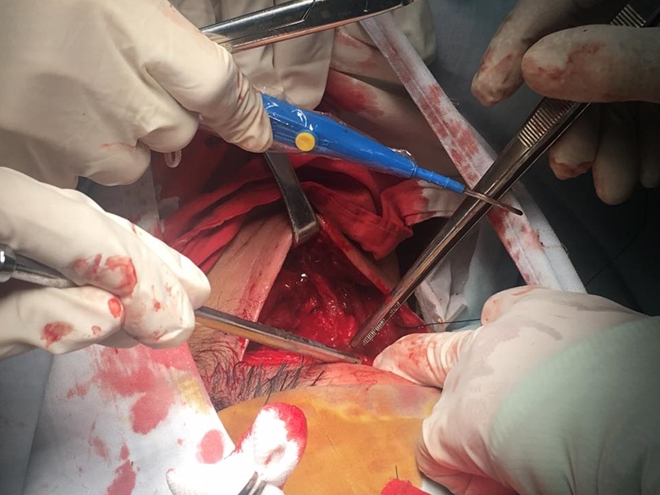 Bị chém vào cổ, nam thanh niên may mắn được cứu sống thần kỳ