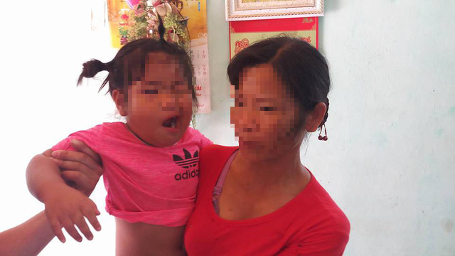 Cháu bé bị méo miệng nghi do cô giáo đánh, cơ quan chức năng nói gì?