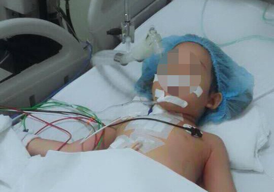 Bé gái bị bút bi xuyên thủng ngực được cứu sống thần kỳ