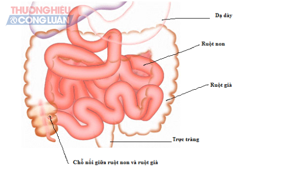 Những dấu hiệu của bệnh khi thường xuyên xuất hiện những cơn đau bụng - Hình 2