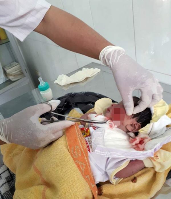 Bình Thuận: Cứu kịp thời bé sơ sinh bị chôn sống - Hình 1