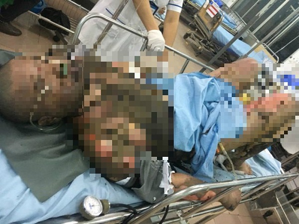 Đồng Tháp: Nam thanh niên tưới 4 lít xăng lên người tự thiêu