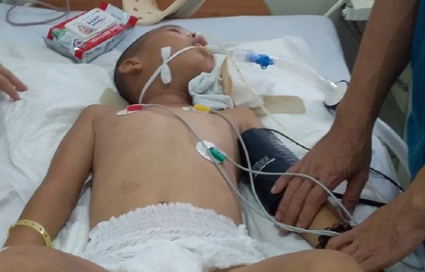 Kiên Giang: Trèo cây hái quả, bé trai 12 tuổi bị ngã dập tủy sống