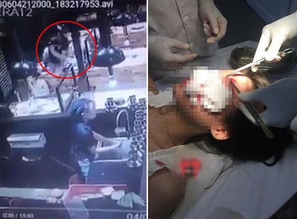 Truy bắt đối tượng trêu ghẹo rồi hành hung phụ nữ tại Nam Định - Hình 1