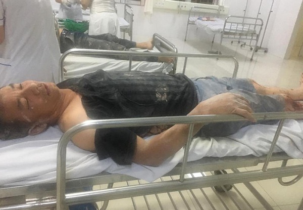 Quảng Ninh: 3 người bị hành hung nhập viện do mâu thuẫn cá nhân - Hình 1
