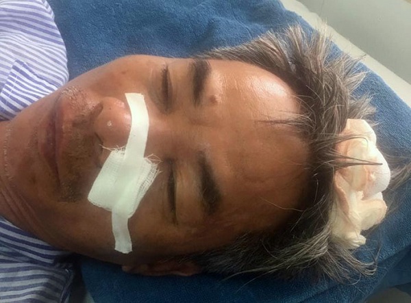 Quảng Ninh: 3 người bị hành hung nhập viện do mâu thuẫn cá nhân - Hình 2