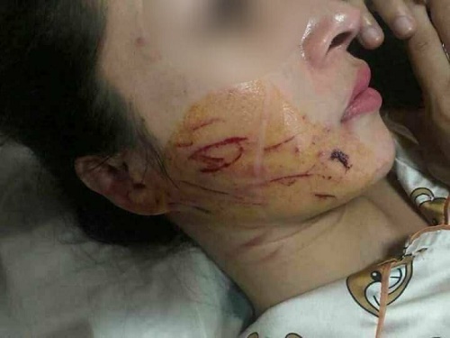 Khởi tố vụ cô gái bị lột đồ, rạch mặt ở Thanh Hóa