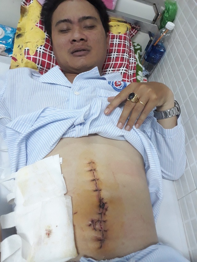 TP. HCM: Giám đốc Công ty bất động sản vô cớ bị đánh thủng ruột