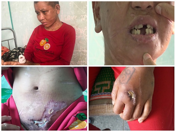 Đối tượng “tra tấn người giúp việc” như thời trung cổ ở Gia Lai có thể đối mặt những tội danh nào?