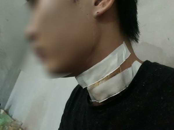 Bắc Ninh: Tài xế taxi bị cứa cổ