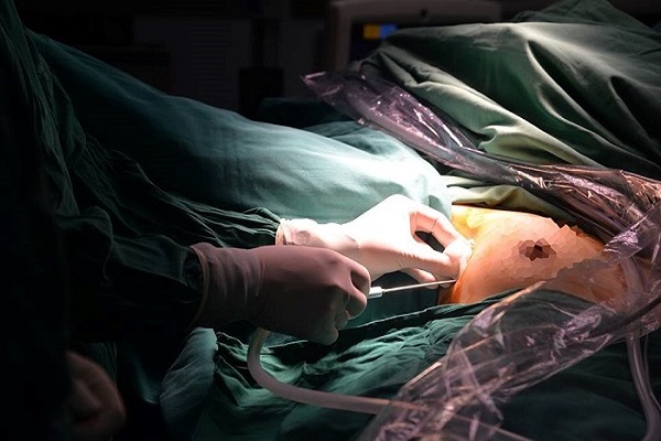 Việt Nam thực hiện thành công kỹ thuật nội soi tuyến giáp một lỗ - Hình 1