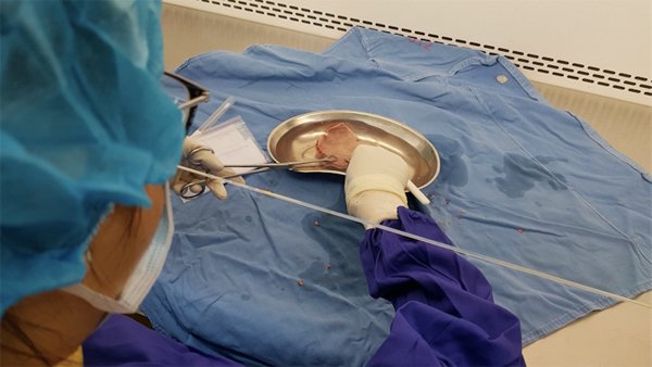 Việt Nam chính thức có Ngân hàng mô, bảo quản từ xương sọ tới van tim