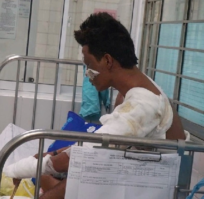 Đà Nẵng: 8 nạn nhân bị thương nặng vụ nổ tàu cá đã qua cơn nguy kịch - Hình 1