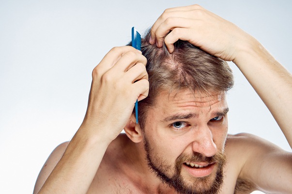 Giải pháp “hồi sinh” mái tóc cho quý ông hói đầu - Hình 1