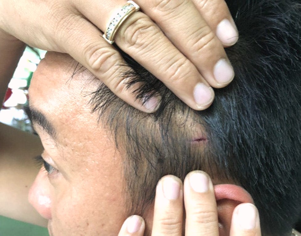 Bình Định: Cần xử lý nghiêm về hành vi của tài xế xe tải BKS 37C - 041.77