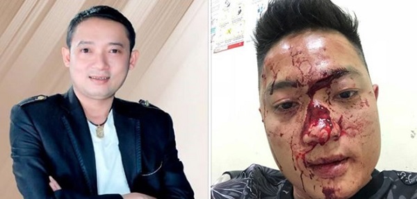 Danh hài Chiến Thắng phủ nhận việc thuê vệ sĩ đánh khán giả