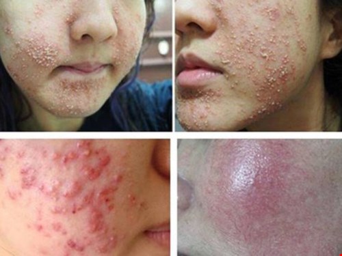 Hiểm họa từ mỹ phẩm giả - Bài 2: Mỹ phẩm DỎM bủa vây - người tiêu dùng khó tránh