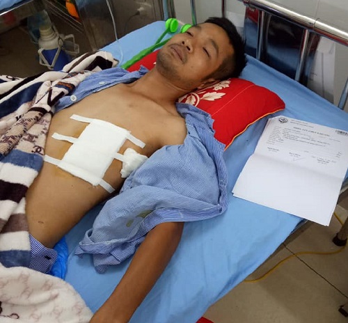 Bắc Giang: Nam thanh niên suýt mất mạng vì bị tấn công bằng súng, dao bầu?