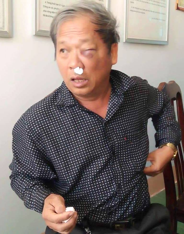 Kon Tum: Côn đồ hành hung phóng viên VTV