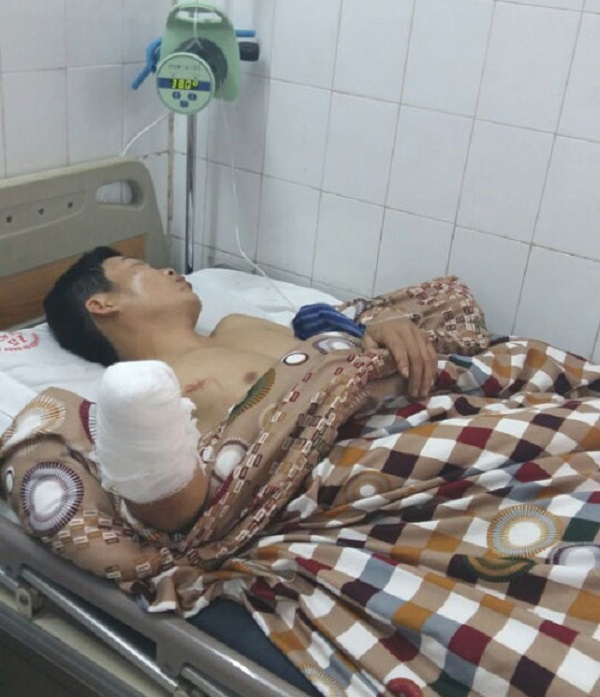 313 người “xông đất” bệnh viện do tai nạn pháo nổ