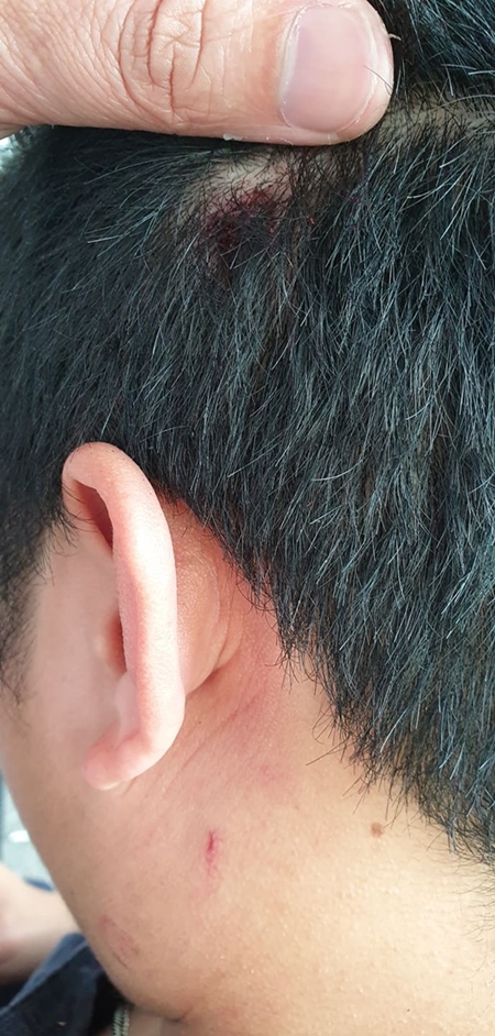 Phóng viên Tạp chí Thương Trường bị hành hung khi tác nghiệp