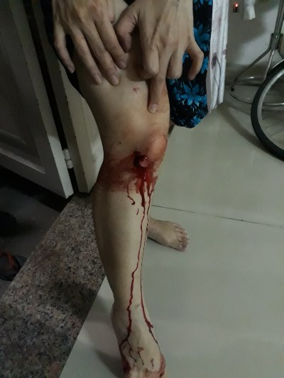 Trả lời thư bạn đọc