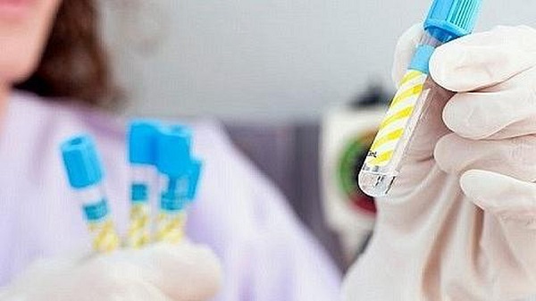 Hà Nội: Gần 500.000 người dân được tầm soát ung thư đại trực tràng sớm