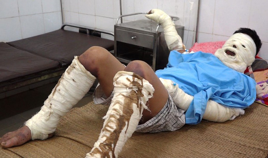 Thạch Thành (Thanh Hóa): Nổ bình ga khiến 5 người bị thương nặng