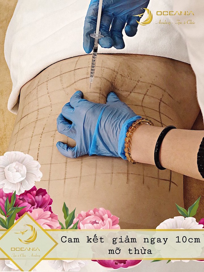 Giảm mỡ bụng tại spa, thẩm mỹ viện bằng cách tiêm thuốc tiềm ẩn nhiều hệ luỵ