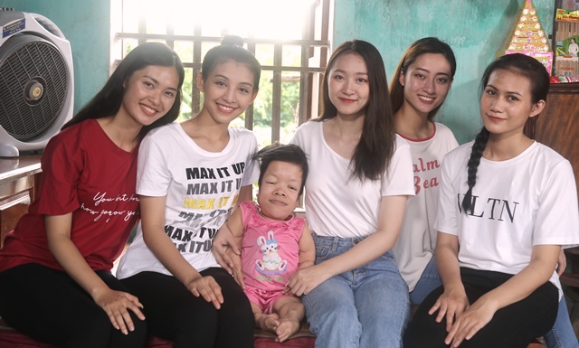 Miss World Việt Nam 2019: Kì tích của cô gái dị tật bẩm sinh - Hình 1