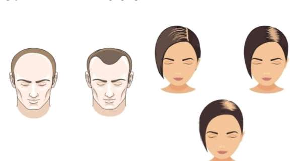 Bí ẩn “giới tính” sợi tóc - Hình 2