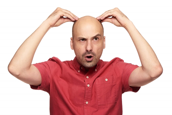 Hói đầu di truyền, thưa tóc bẩm sinh: Làm sao “cải mệnh”?