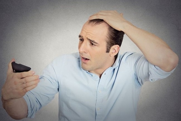 Hói đầu di truyền, thưa tóc bẩm sinh: Làm sao “cải mệnh”? - Hình 2