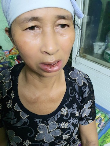 Bà Bùi Thị Lưu mẹ chị Thu bị các đối tượng gây tai nạn cùng ngày xảy ra sự việc