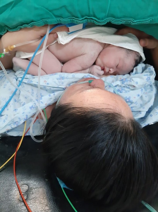 Phụ sản Ngời sinh hạ bé gái 39 tuần nặng 3600 gram