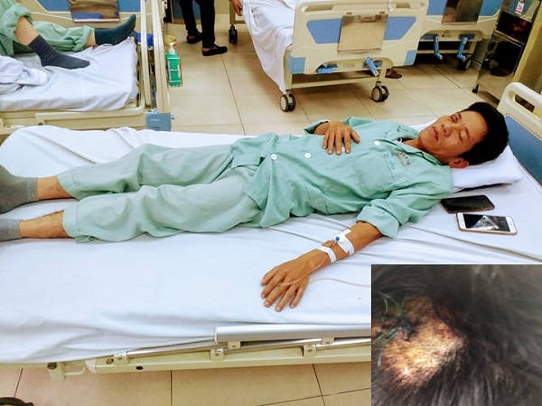 Hà Nội: Cần xử lý hành vi côn đồ đánh người trọng thương phải nhập viện