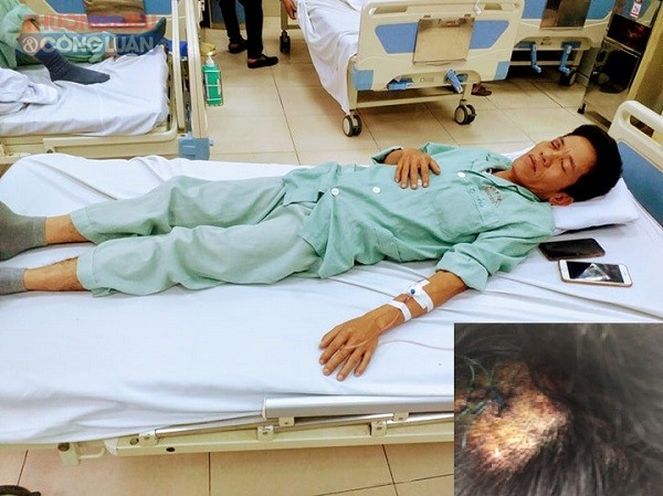 Nạn nhân Nguyễn Văn Hải bị đối tượng Nguyễn Duy Khánh hành hung phải nhập viện