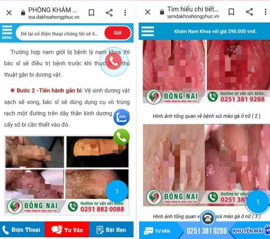Hình ảnh bộ phận sinh dục nam, nữ PKĐK Hồng Phúc Đồng Nai đăng trên website