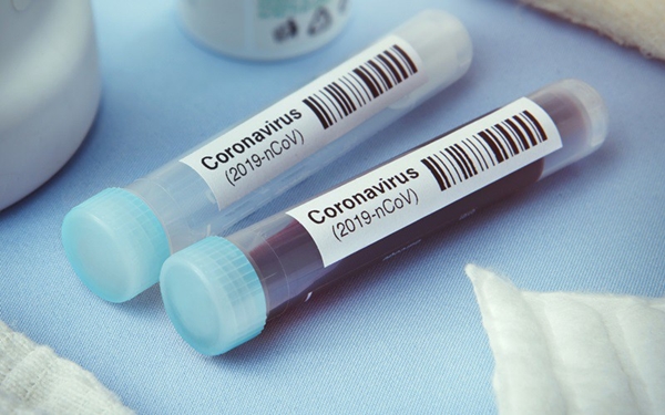 Hà Nội bắt đầu xét nghiệm nhanh Covid-19 diện rộng