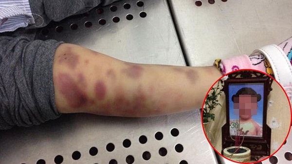 Khởi tố vụ án bé gái 3 tuổi tử vong nghi do mẹ, bố dượng bạo hành