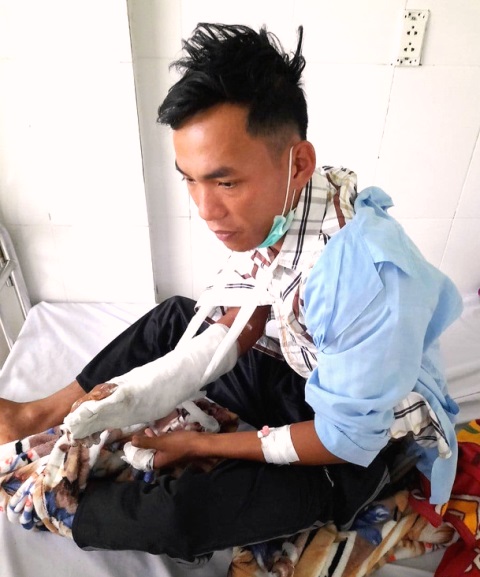 Kon Tum: Nhân viên bảo vệ rừng bị chém trọng thương vì không cho xe độ chế vào rừng