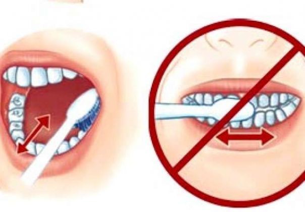 Vệ sinh răng miệng sai cách làm tăng nguy cơ bị hôi miệng
