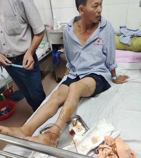 Hà Tĩnh: Sẽ xử lý nghiêm 3 cha con hành hung, chém đứt gân chân công an xã