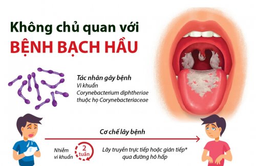 Lào Cai: Tăng cường công tác phòng, chống bệnh bạch hầu