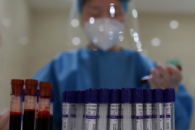 Bác sĩ Trung Quốc thu thập mẫu máu từ tình nguyện viên tiêm ngừa vaccine Covid-19 đang thử nghiệm. Ảnh: CFP.