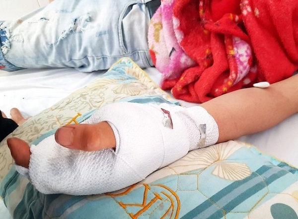 Bé trai 9 tuổi dập bàn tay vì chơi điện thoại đang sạc pin