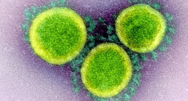 Các nhà nghiên cứu đã phát hiện ra một gen bí ẩn trong mã di truyền của virus SARS-CoV-2