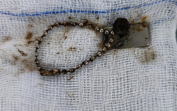 TP. HCM: Bé trai 6 tuổi thủng ruột, nhiễm trùng nặng do nuốt dị vật